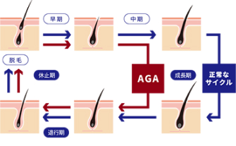 カウンセリング